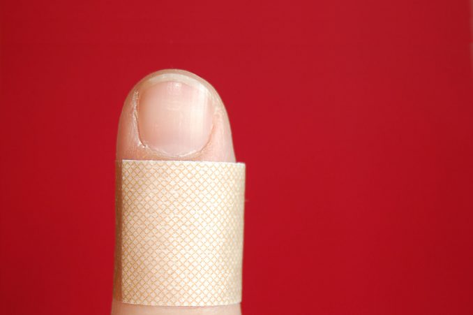 hurt finger